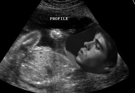  Matthew in a ultrasound pic. XD
