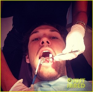  Alex took a selfie at the dentist lol