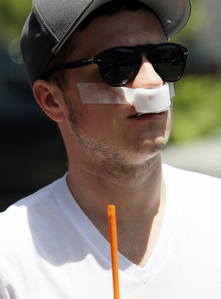  Josh Hutcherson broken nose :(