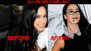  AJ Lee before and after her chin toupeira implant