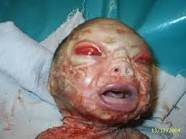  Baby Cryotien v (Well actually this is a real human baby, but moments after birth it died. This is