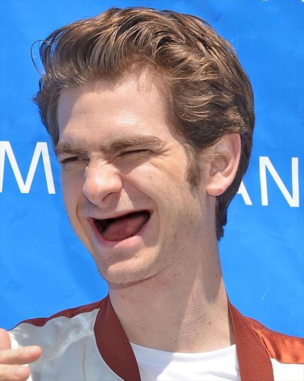Celebs With No Teeth! - Funny Celebrity Moments Photo (34438204) - Fanpop