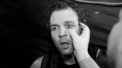  Dean Ambrose's Eye Injury