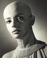 Persis Khambatta (2 October 1948 – 18 August 1998 - celebrities-who-died-young photo