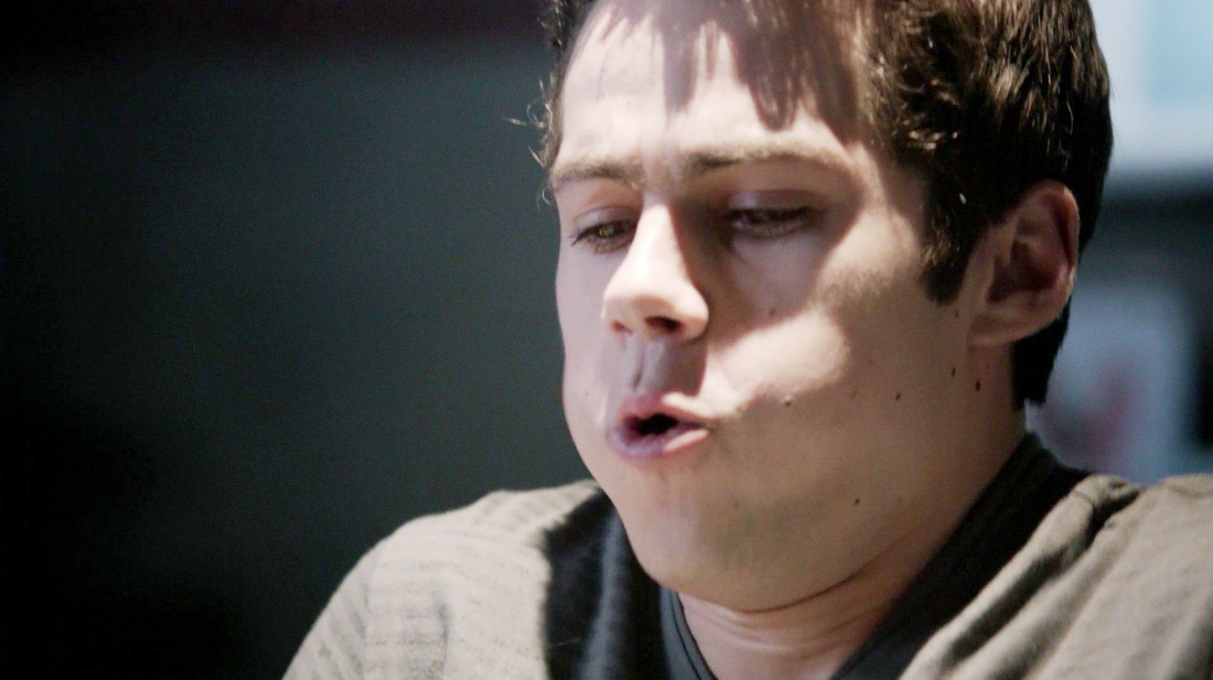 funny faces, 3x11 - Teen Wolf Photo (35293352) - Fanpop