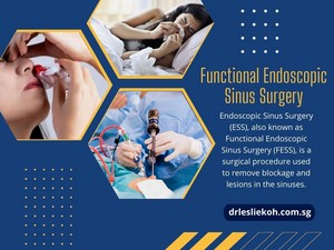  Functional Endoscopic Sinus Surgery
