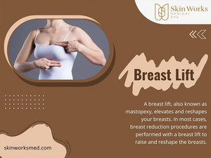  Breast Lift