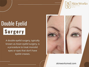  Double Eyelid Surgery