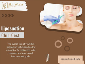  Liposuction Chin Cost