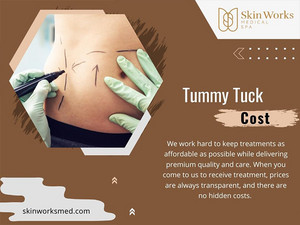  Tummy Tuck Cost