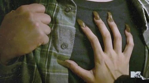  Who's claws are these on Stiles's chest
