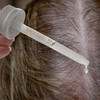 Hair loss in women newinhairtransp photo