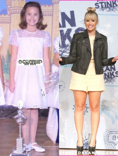  Demi Lovato Before And After