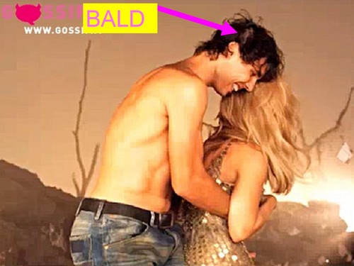 Nadal bald and embrace with Shakira
