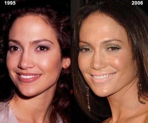  Jennifer Lopez then and now, before and after 1995 2006