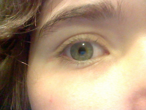  My eye
