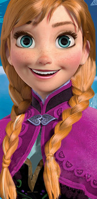 Anna without the cross eyes