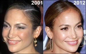  JLo then and now before and after 2001 2012