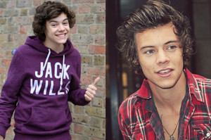  Harry - Before and After ❤