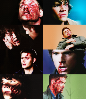  Sam and Dean Bleeding