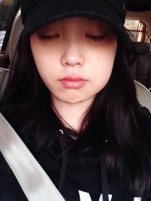  [141024] 李知恩 got her wisdom teeth removed yesterday