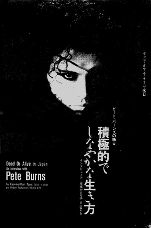 Pete Burns