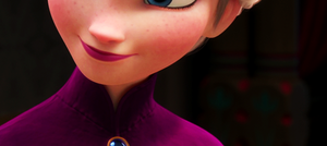  Elsa + freckles