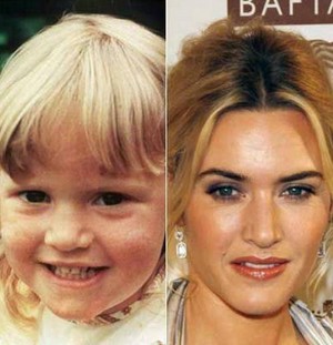  Kate then and now