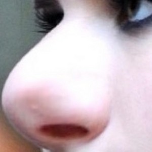  Emma's Lovely Nose